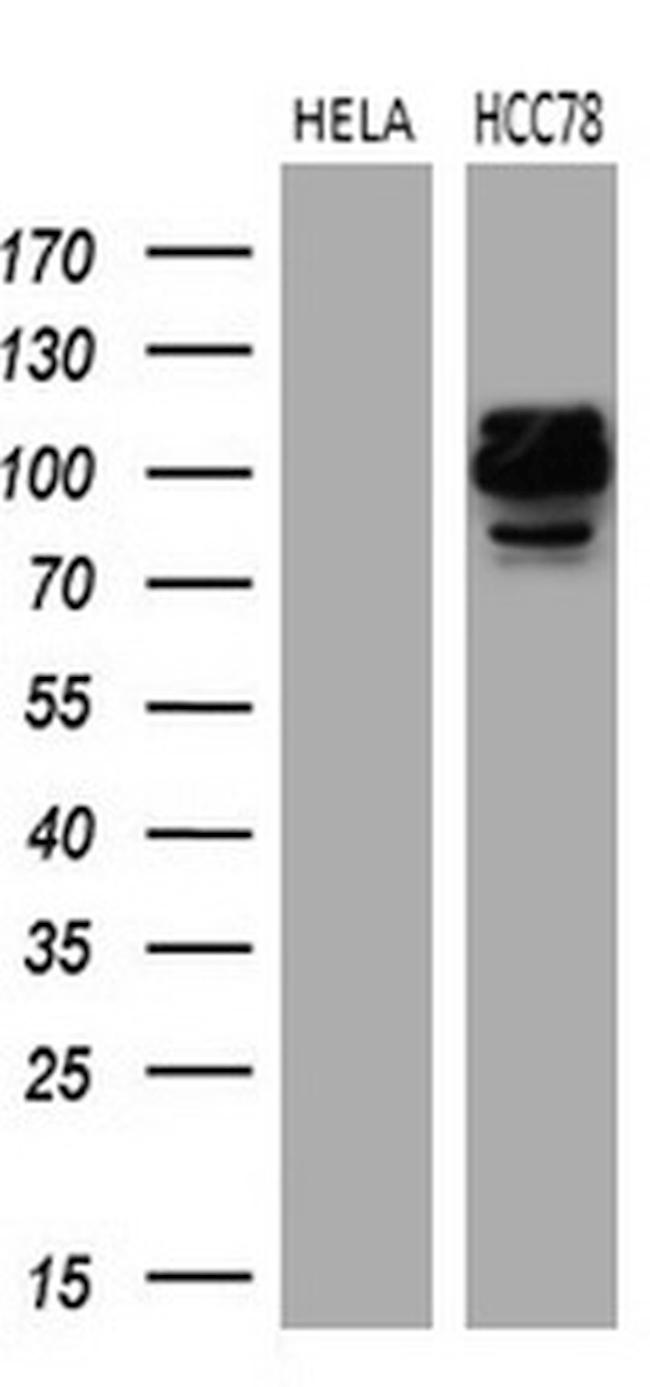 ROS1 Antibody in Western Blot (WB)