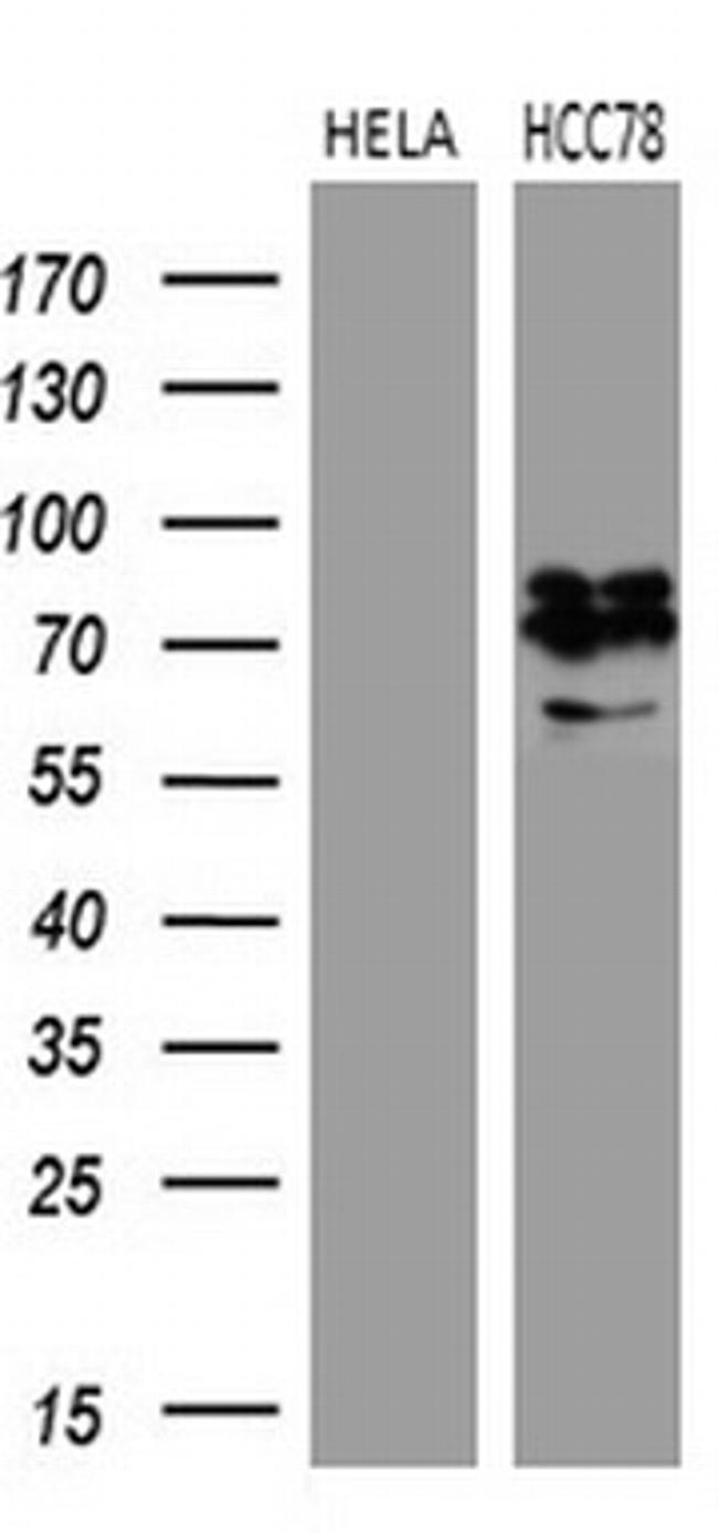 ROS1 Antibody in Western Blot (WB)