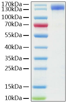 Human ACE2 (aa18-740) Fc Chimera Protein in SDS-PAGE (SDS-PAGE)