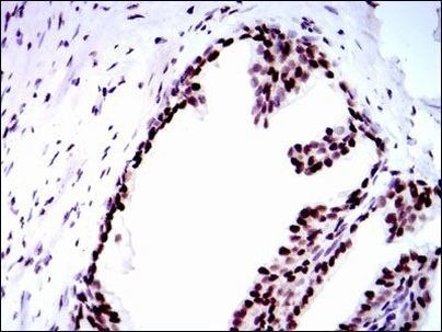 RPA70 Antibody in Immunohistochemistry (Paraffin) (IHC (P))