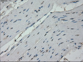 RPA2 Antibody in Immunohistochemistry (Paraffin) (IHC (P))