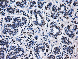 RPA2 Antibody in Immunohistochemistry (Paraffin) (IHC (P))