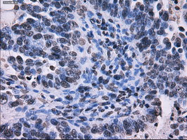 RPA2 Antibody in Immunohistochemistry (Paraffin) (IHC (P))