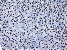 RPA2 Antibody in Immunohistochemistry (Paraffin) (IHC (P))