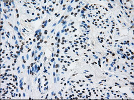 RPA2 Antibody in Immunohistochemistry (Paraffin) (IHC (P))