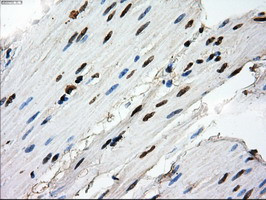 RPA2 Antibody in Immunohistochemistry (Paraffin) (IHC (P))