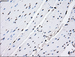 RPA2 Antibody in Immunohistochemistry (Paraffin) (IHC (P))