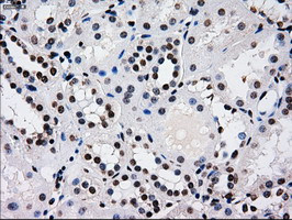 RPA2 Antibody in Immunohistochemistry (Paraffin) (IHC (P))