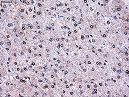 RPA2 Antibody in Immunohistochemistry (Paraffin) (IHC (P))