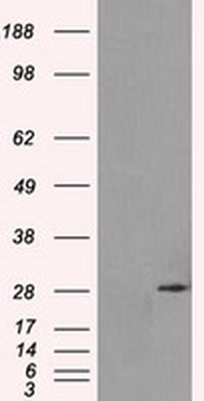 RPA2 Antibody in Western Blot (WB)