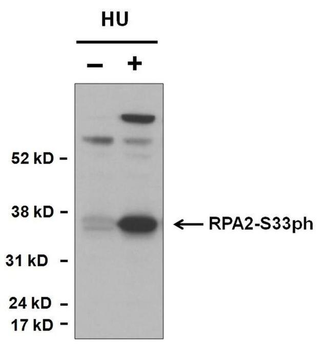 Phospho-RPA2 (Ser33) Antibody in Western Blot (WB)