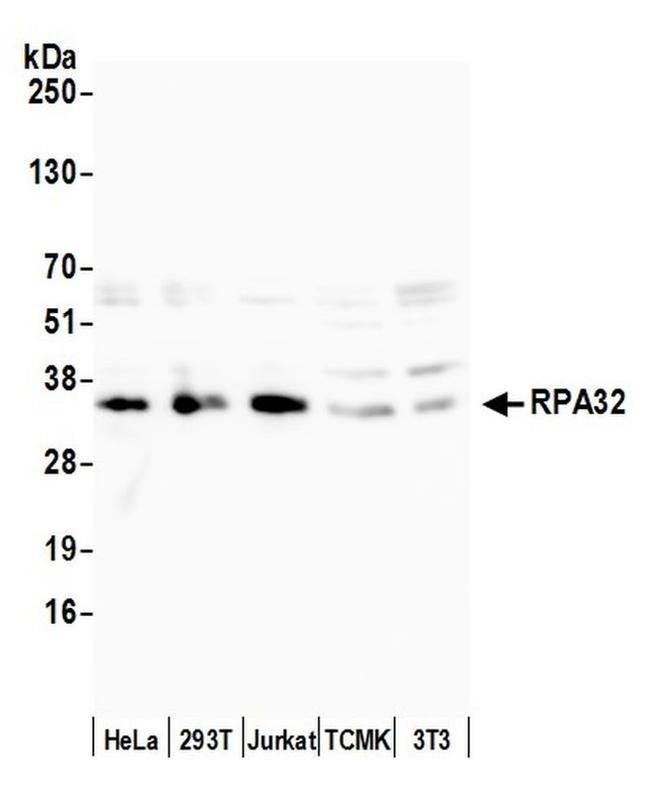 RPA32 Antibody in Western Blot (WB)