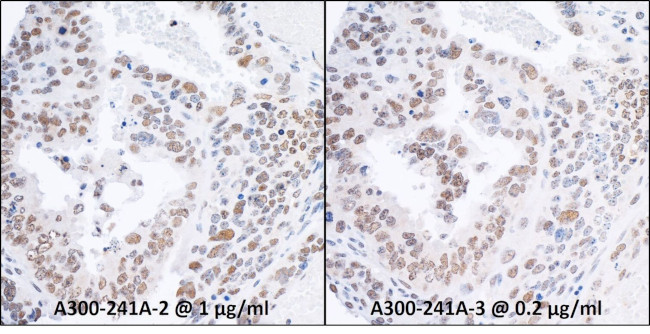 RPA70 Antibody in Immunohistochemistry (IHC)