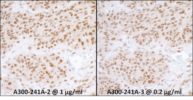 RPA70 Antibody in Immunohistochemistry (IHC)