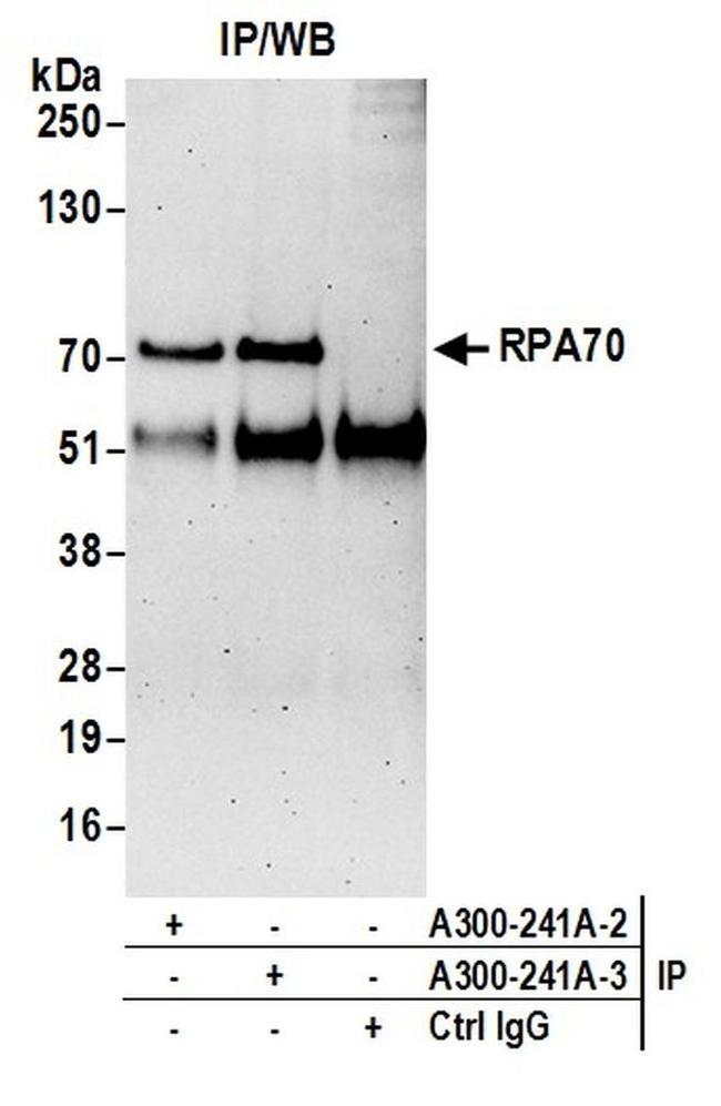 RPA70 Antibody in Western Blot (WB)