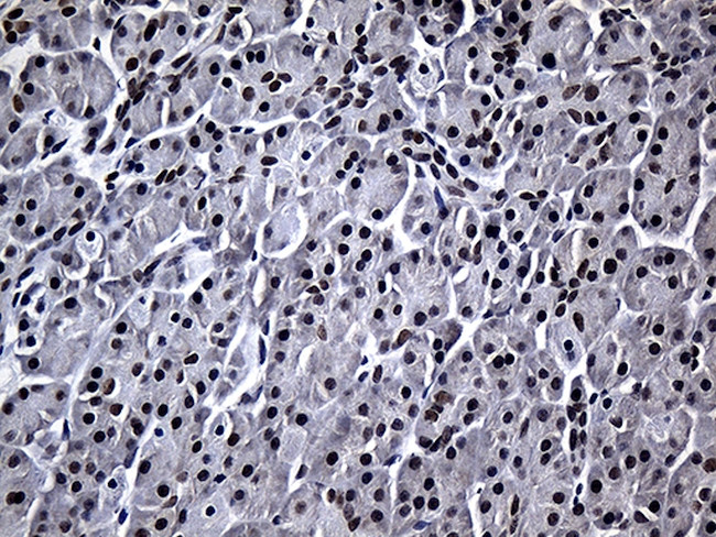 RPAIN Antibody in Immunohistochemistry (Paraffin) (IHC (P))