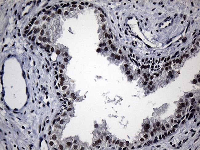 RPAIN Antibody in Immunohistochemistry (Paraffin) (IHC (P))