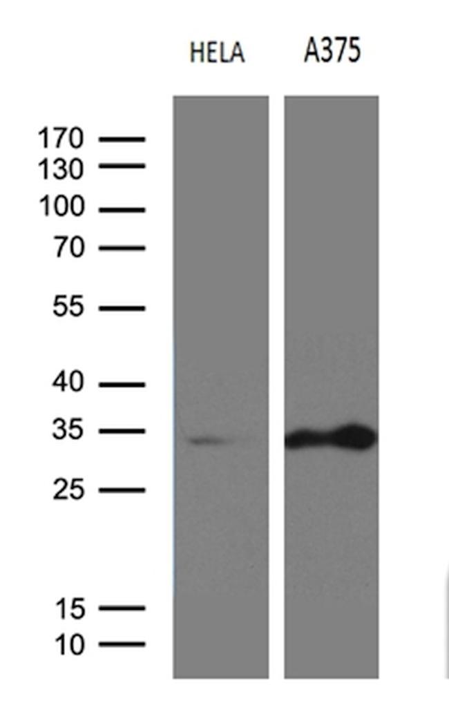 RPAIN Antibody in Western Blot (WB)