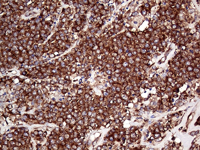 RPL10A Antibody in Immunohistochemistry (Paraffin) (IHC (P))