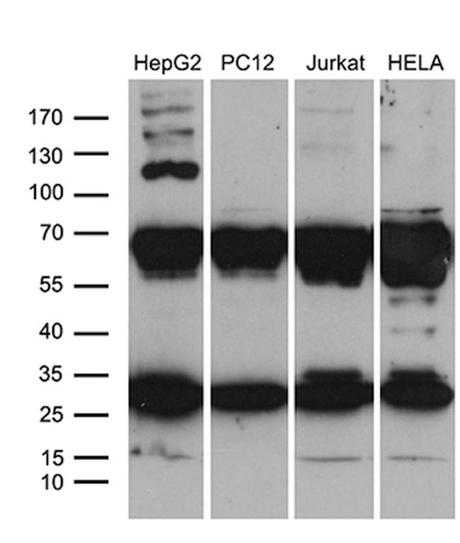 RPL10A Antibody in Western Blot (WB)