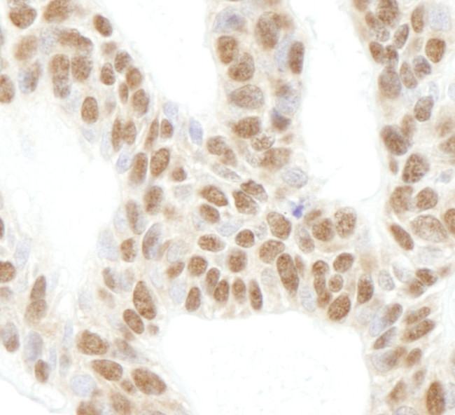 RPL26 Antibody in Immunohistochemistry (IHC)
