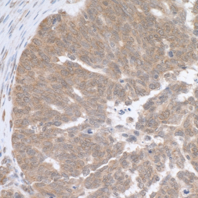 RPL5 Antibody in Immunohistochemistry (IHC)