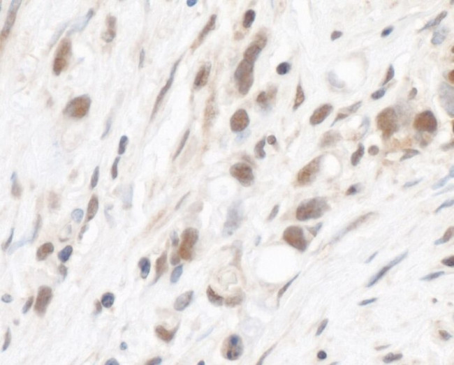 RPL5 Antibody in Immunohistochemistry (IHC)