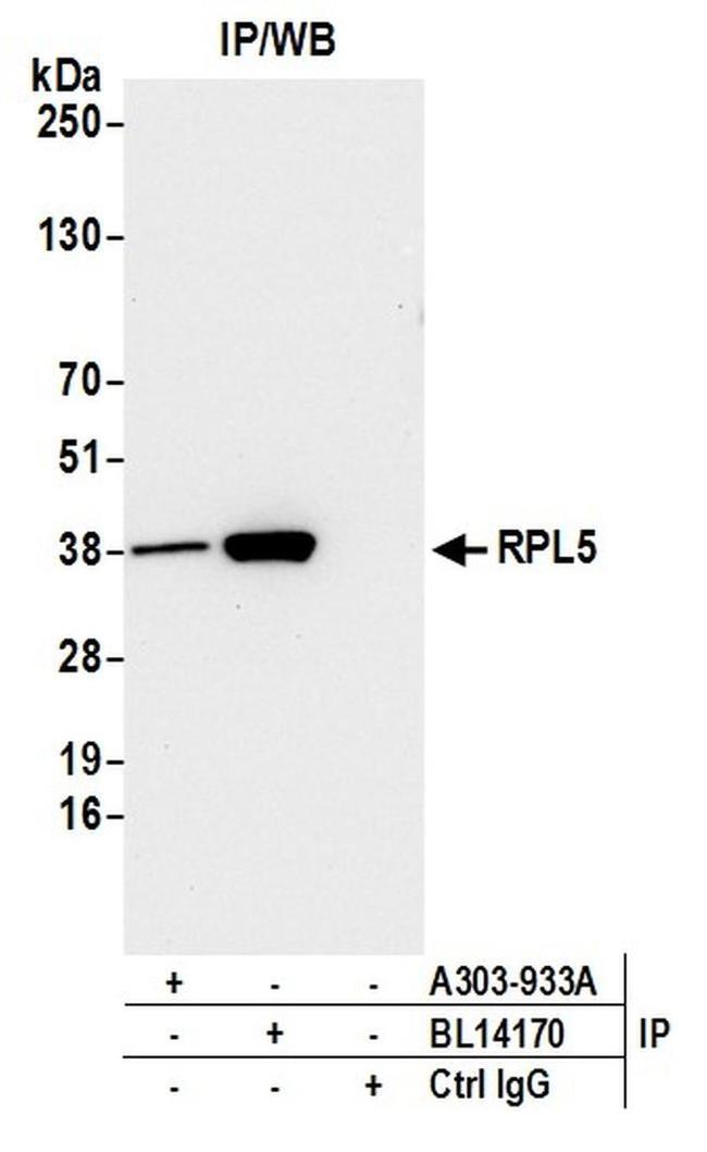 RPL5 Antibody in Western Blot (WB)