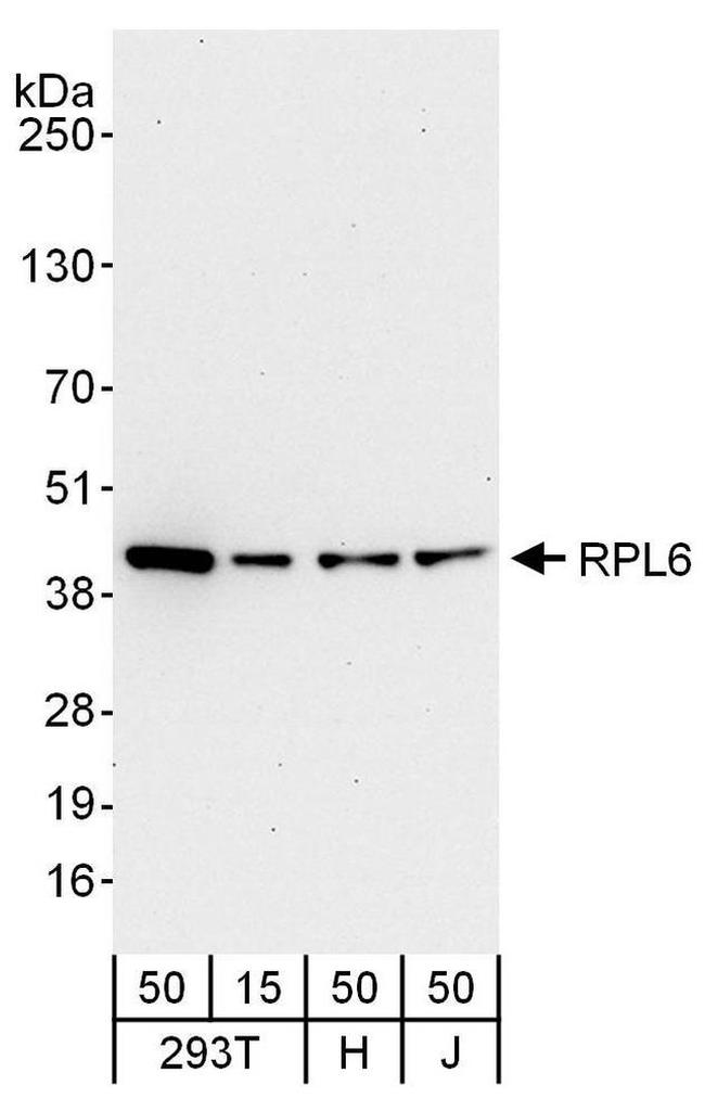 Rpl6 Polyclonal Antibody A303 587a 5297