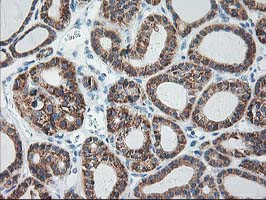 RPN1 Antibody in Immunohistochemistry (Paraffin) (IHC (P))