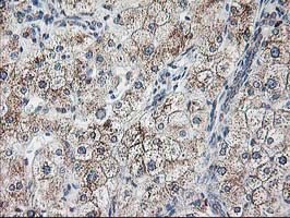 RPN1 Antibody in Immunohistochemistry (Paraffin) (IHC (P))