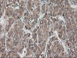 RPN1 Antibody in Immunohistochemistry (Paraffin) (IHC (P))