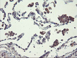 RPN1 Antibody in Immunohistochemistry (Paraffin) (IHC (P))