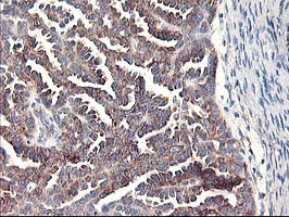 RPN1 Antibody in Immunohistochemistry (Paraffin) (IHC (P))