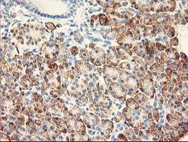 RPN1 Antibody in Immunohistochemistry (Paraffin) (IHC (P))