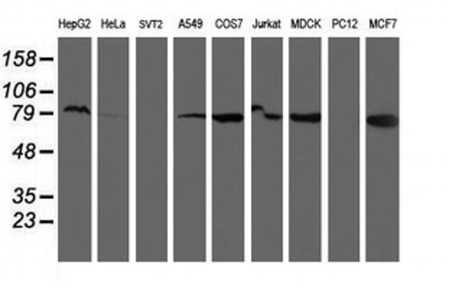 RPN1 Antibody in Western Blot (WB)