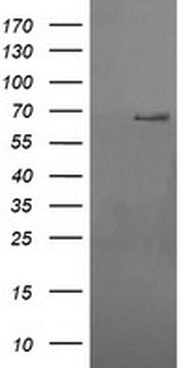 RPN1 Antibody in Western Blot (WB)