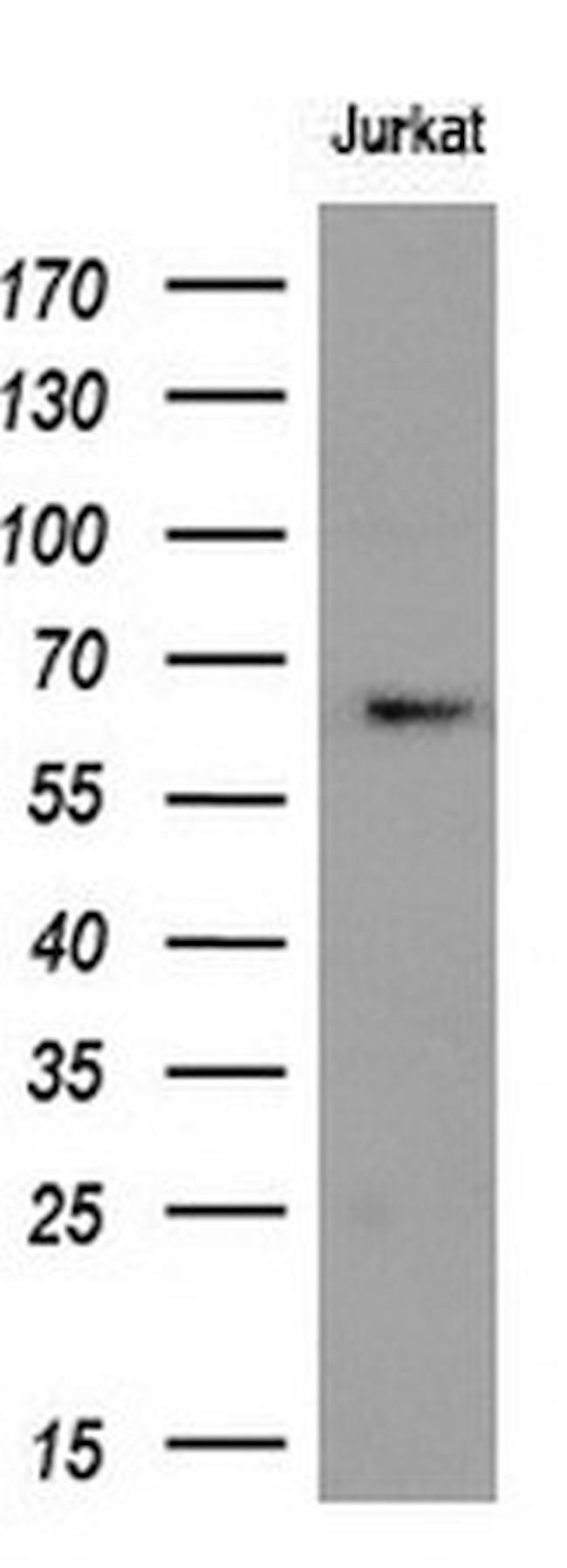 RPN1 Antibody in Western Blot (WB)