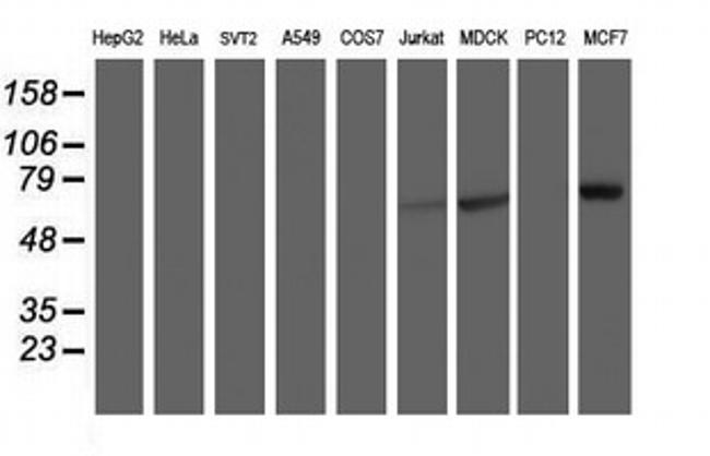 RPN1 Antibody in Western Blot (WB)