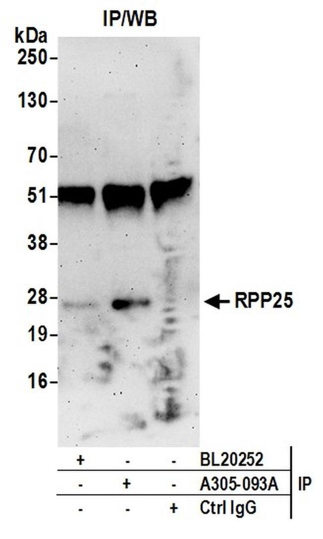 RPP25 Antibody in Western Blot (WB)