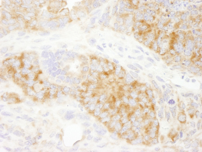 RPS6 Antibody in Immunohistochemistry (IHC)