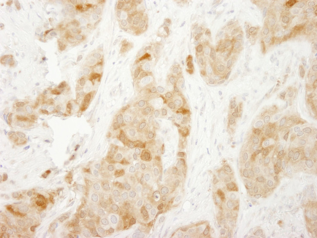 RPS6 Antibody in Immunohistochemistry (IHC)