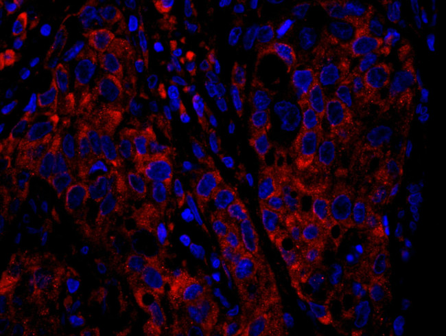 RPS6 Antibody in Immunohistochemistry (IHC)