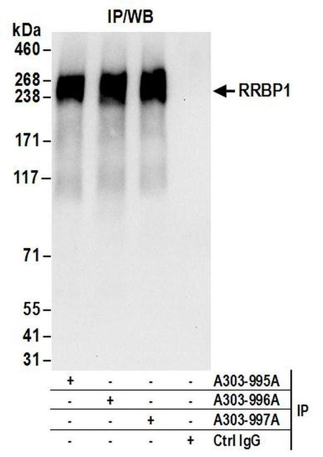 Rrbp1 Polyclonal Antibody A303 996a 0854
