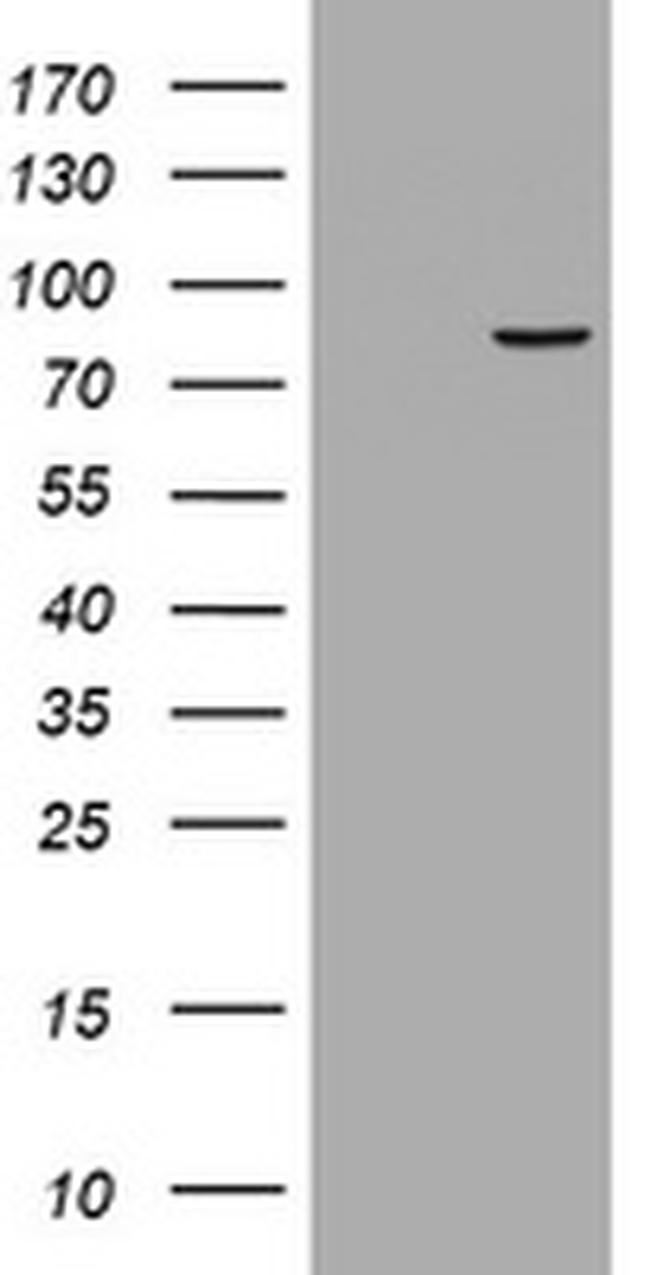 RRM1 Antibody in Western Blot (WB)