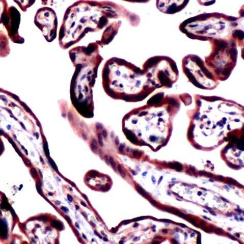 RRM1 Antibody in Immunohistochemistry (IHC)