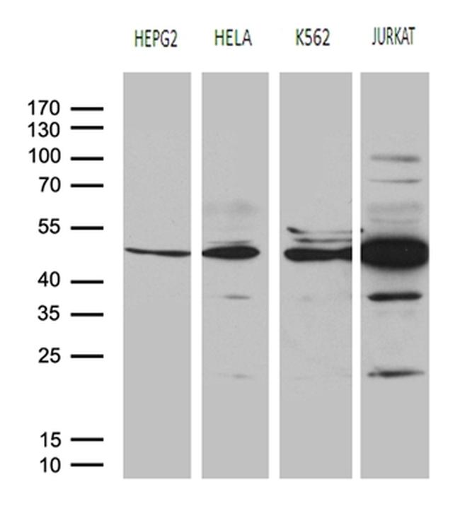 RRM2 Antibody in Western Blot (WB)