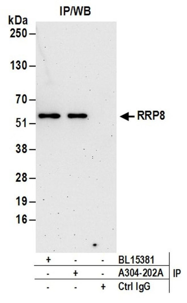 RRP8 Antibody in Immunoprecipitation (IP)