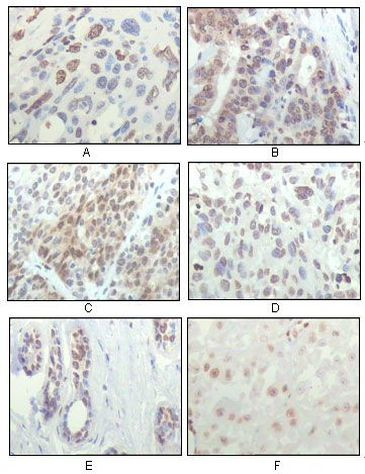 RSK1 Antibody in Immunohistochemistry (Paraffin) (IHC (P))