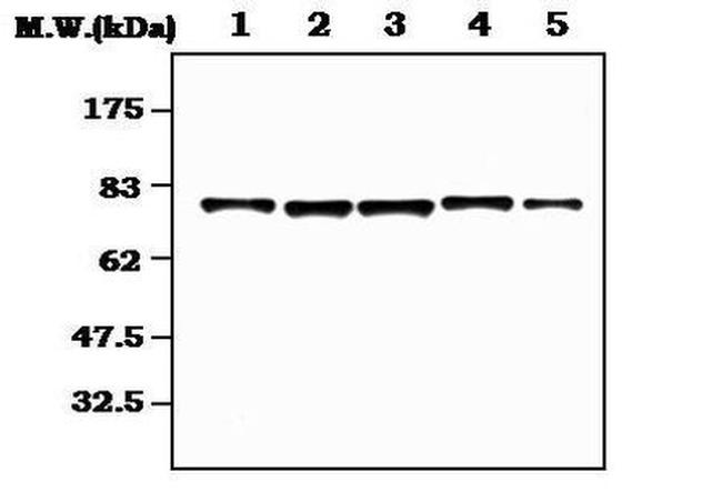 RSK2/RSK3 Antibody in Western Blot (WB)